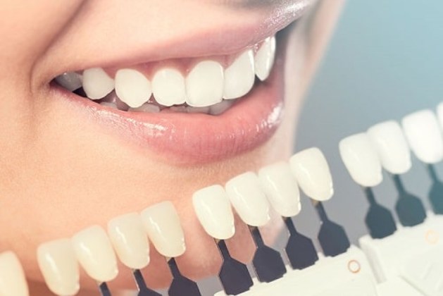 Few things to know before taking up the Invisalign procedure