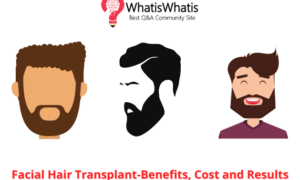 Facial Hair Transplant-Benefits, Cost and Results