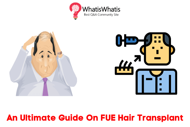 An Ultimate Guide On FUE Hair Transplant