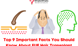 Top 9 Important Facts You Should Know About FUE Hair Transplant