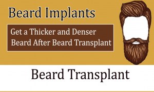 Beard Implants- Get a Thicker and Denser Beard After Beard Transplant