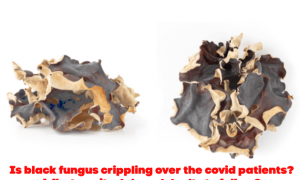 Is black fungus crippling over the covid patients? What are its do’s and don’ts to follow?