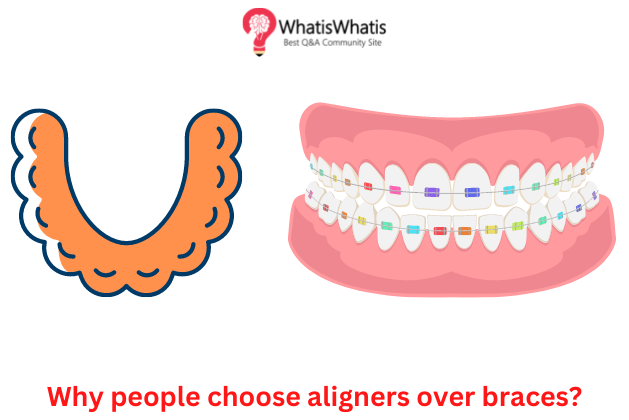 Know why people choose teeth aligners over braces!